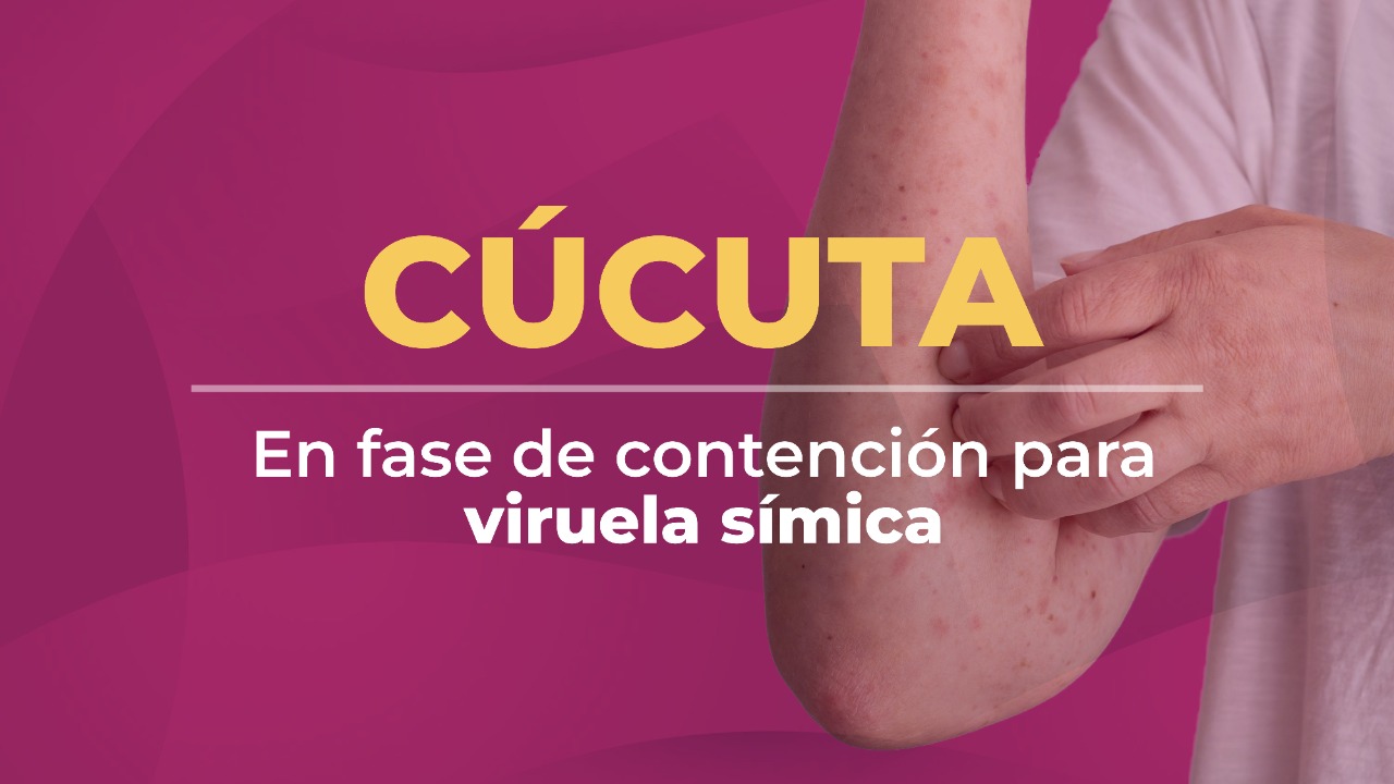 CÚCUTA INCREMENTA VIGILANCIA EPIDEMIOLÓGICA ANTE VIRUELA SÍMICA »